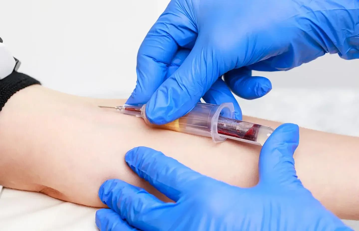 Bessere Diagnosen durch geschulte Präanalytik