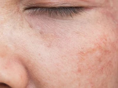 Haarpflege von Olaplex: Die ultimative Lösung für starkes und widerstandsfähiges Haar