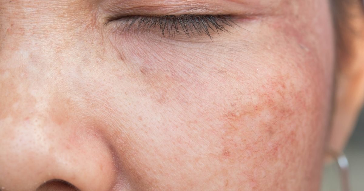Haarpflege von Olaplex: Die ultimative Lösung für starkes und widerstandsfähiges Haar