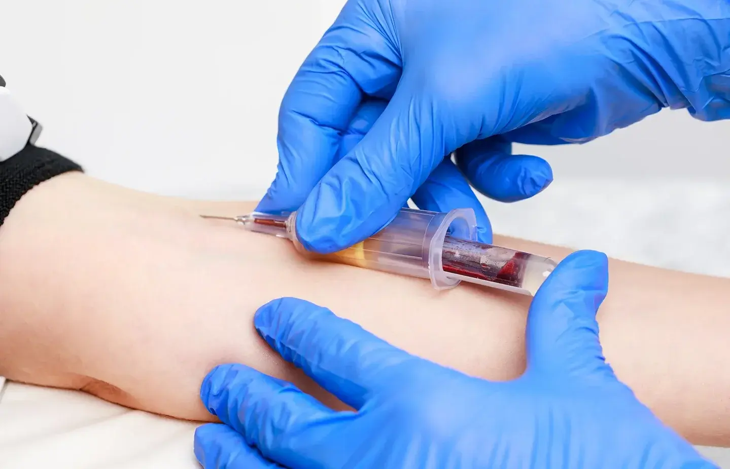Bessere Diagnosen durch geschulte Präanalytik